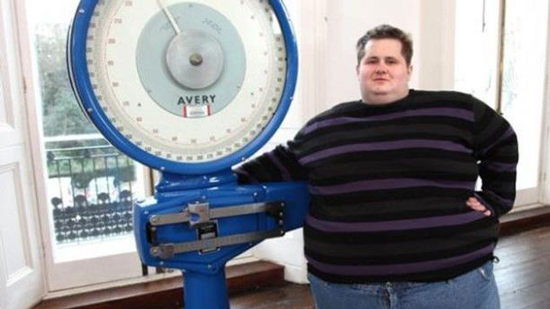 بالصور.. كيف خسر هذا الشاب 180 كيلو من وزنه في 18 شهراً فقط؟