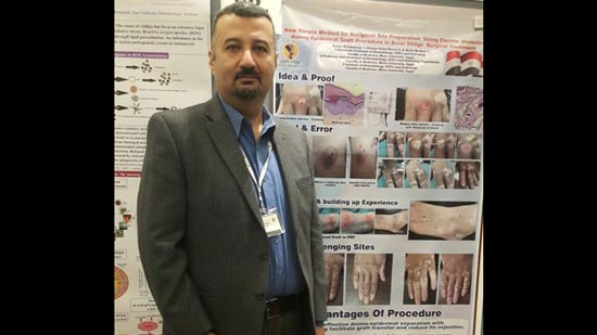 طبيب مصري يكشف عن بحث علمي جديد لعلاج البهاق بمؤتمر عالمي في إيطاليا