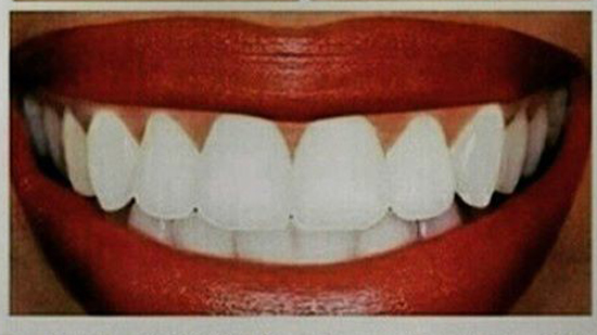داعية: لا حرج في ترك طقم الأسنان بفم المتوفى