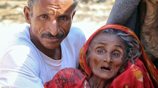 الأمم المتحدة: ثلث محافظات اليمن على شفير المجاعة