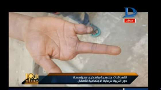 بالفيديو| نزيل دار أيتام بالجيزة: وجدت طفلا مفقوء العين ومقطوع اليد من التعذيب