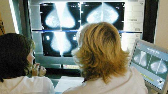  إنجلترا توافق على علاج يطيل حياة المصاب بسرطان الرئة