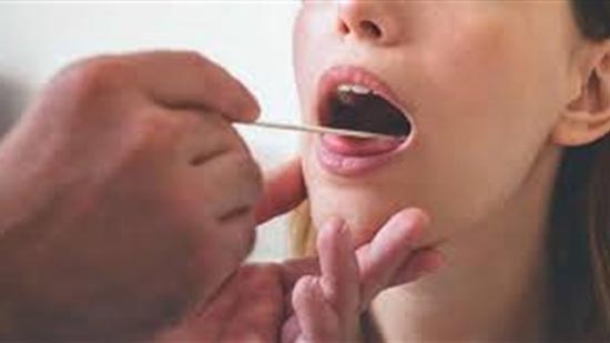 بكتيريا الفم قد تسبب اضطرابات الأمعاء