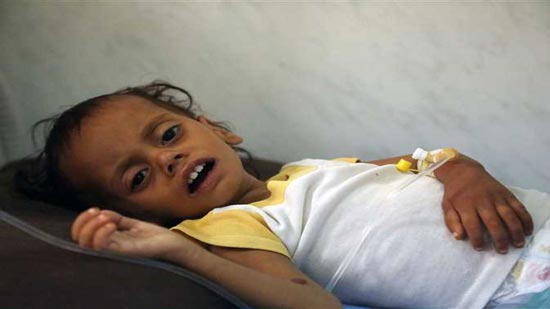 اليمن «التعيس».. أسوأ مكان لأطفال العالم