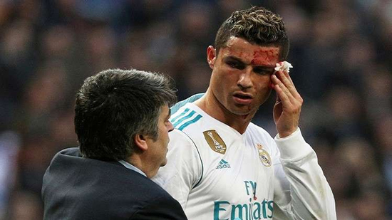  ريال مدريد ينشر فيديو يظهر شدة إصابة رونالدو