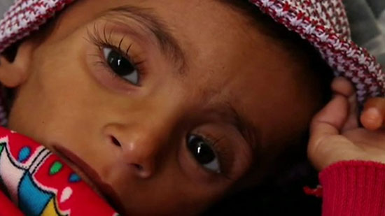  الموت جوعا يهدد 13 مليون يمني خلال الأشهر المقبلة