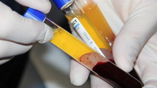 الصحة: 28 مركز دم ضمن المشروع القومي لتجميع وتصنيع البلازما بمصر