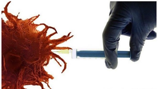 مفاجأة فيروس وراثي معدل يقتل الخلايا السرطانية 
