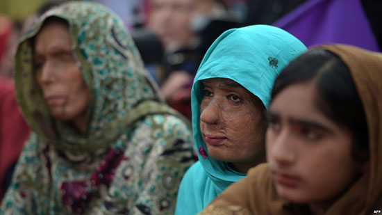 باكستانيات ضحايا هجمات بالأسيد يحتفلن بيوم المرأة العالمي