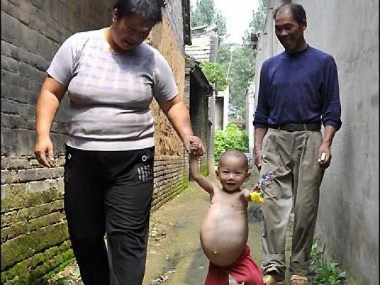 اكتشاف حمل طفلة صينية عمرها سنة واحدة