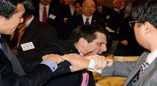  طعن السفير الأمريكي لدى كوريا الجنوبية بسكين في وجهه