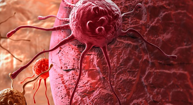 تحويل السرطان إلى خلايا مناعية مفيدة