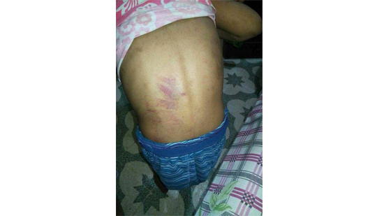 التضامن: تحرير محضر ضد مشرفة دار أيتام بالأقصر لتعذيب الفتيات