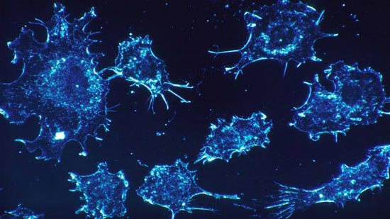 علماء إسرائيليون يكتشفون إنزيما في الخلايا المنوية يستطيع القضاء على الأورام السرطانية