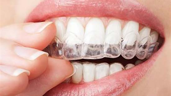 علماء يستخدمون البوتوكس لعلاج صرير الأسنان