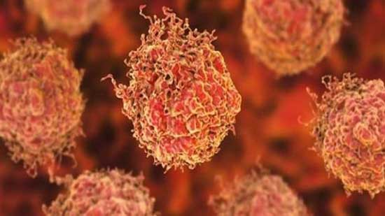  تطوير أسلوب جديد لتشخيص وعلاج سرطان البروستاتا