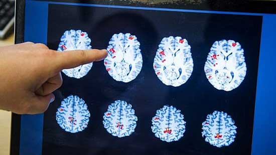  باحث إسرائيلي يطور نموذج يحاكي الدماغ البشري لعلاج الأمراض وإنقاذ حيوانات التجارب