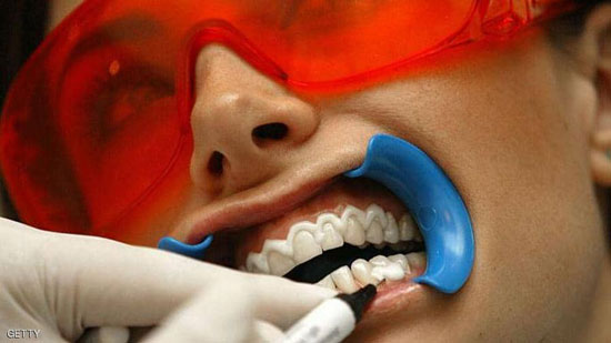 منتجات تبييض الأسنان تؤدي إلى إضعاف الأسنان