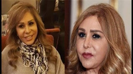 الفنانة مها المصري .. ضحية عمليات التجميل الفاشلة 