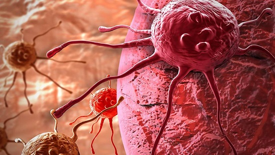 اكتشاف فيروس زكام يعالج سرطان المثانة