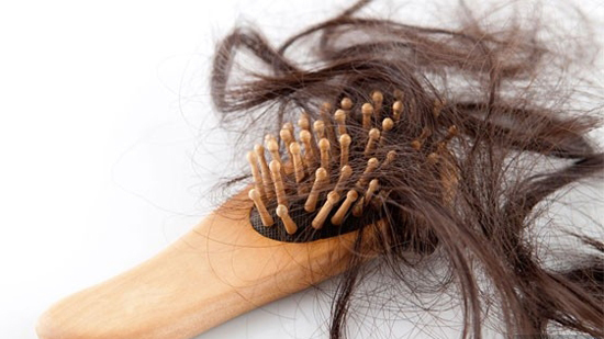 علاج تساقط الشعر الدهني بالأعشاب.. 8 أسرار أبرزها قشر الثوم والبصل