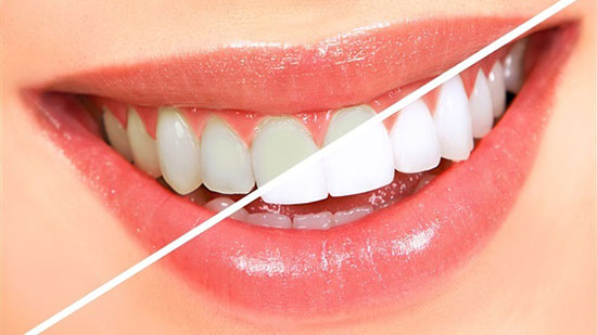 نظافة أسنانك تحميك من 5 مشاكل صحية غير التهابات اللثة.. إنفوجراف
