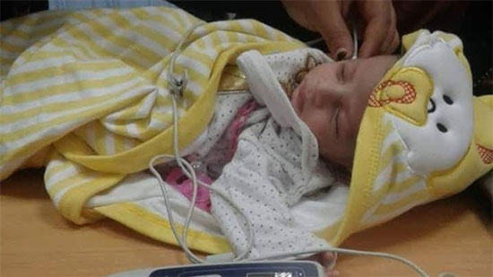 الصحة: فحص 951 ألف طفل بينهم أطفال غير مصريين ضمن مبادرة الرئيس للاكتشاف المبكر وعلاج ضعف السمع