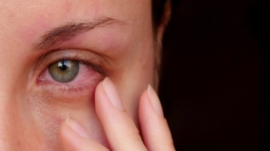 هل تساهم الفيتامينات فى الحفاظ على صحة العين؟
