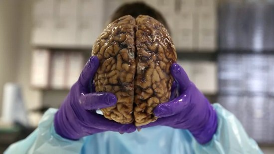 دماغ 