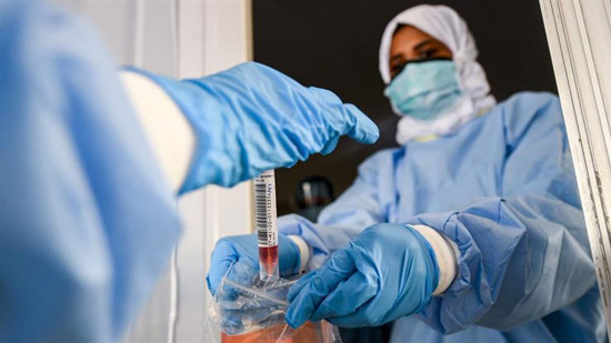 مصر : 722 اصابة جديدة بفيروس كورونا و31 وفاة