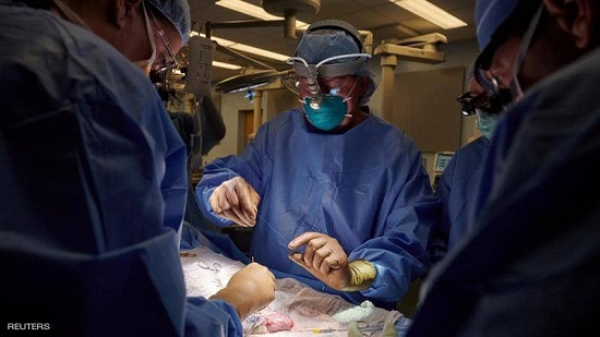 الفريق الجراحي أثناء عملية زراعة الكلية في جسم المريضة