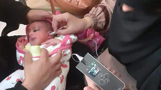 في إطار مبادرة الرئيس السيسي لعلاج ضعف السمع للأطفال حديثي الولادة..  توقيع الكشف الطبي على 11 ألف طفلاً من حديثي الولادة بالمنيا