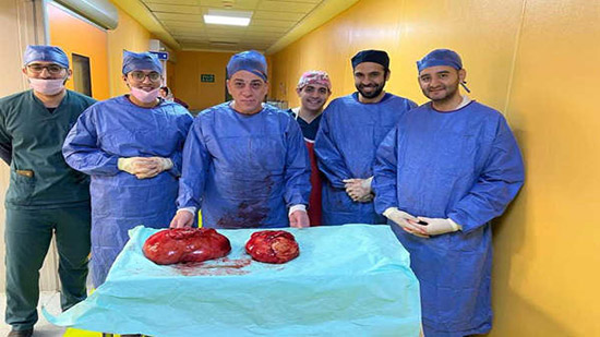 فريق طبي بجامعة أسيوط ينجح في إزالة ورم يزن 20 كيلو جرام 